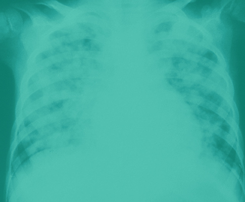 Life In a Time of Corona- Letters from the Ledge_4